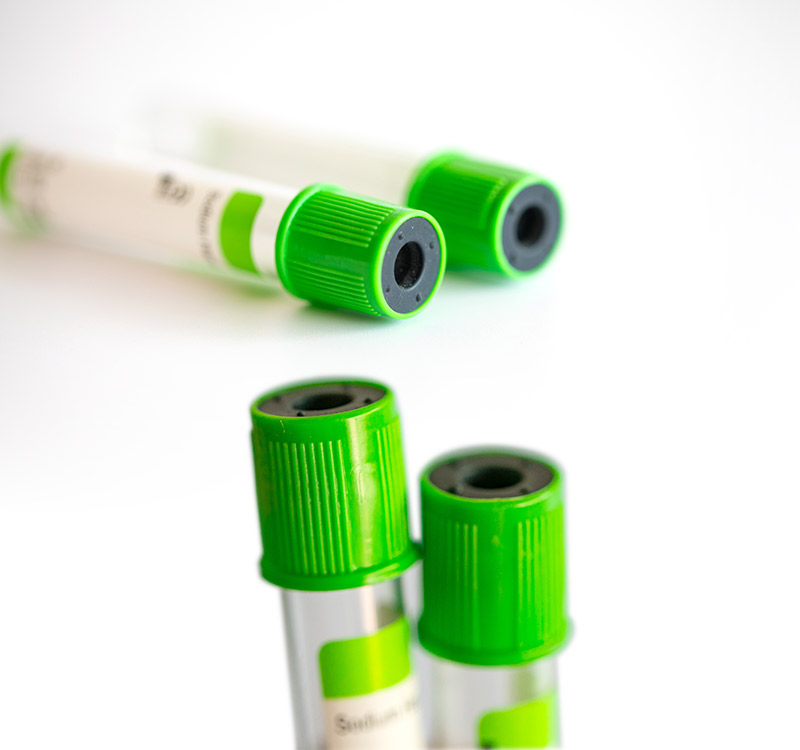 Disposable 2-10ml Pet Vacuum Blood Collection Green Heparin Lithium Tube